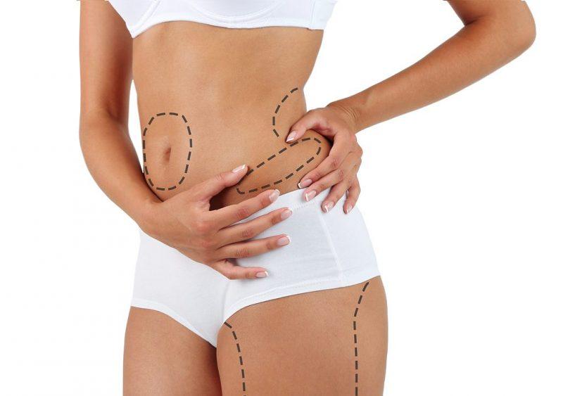 Body Sculpting Dubai