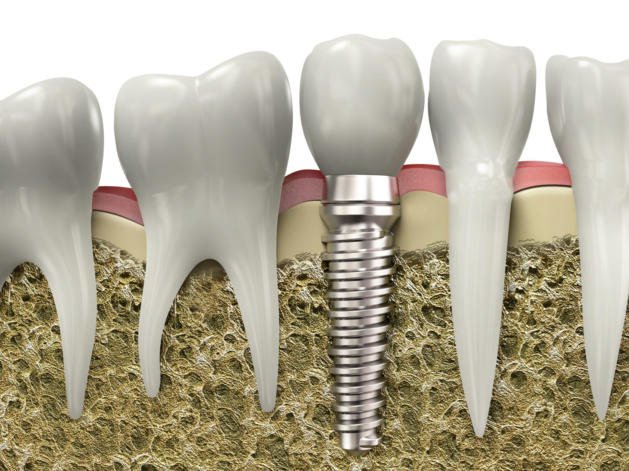 cause of swollen gums cause of swollen gums