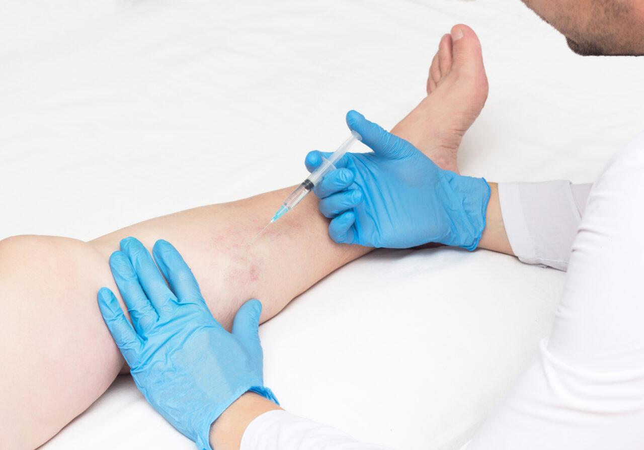 what kind of doctor treats veins