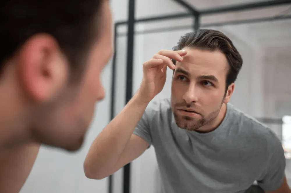 hair transplant after 3 months