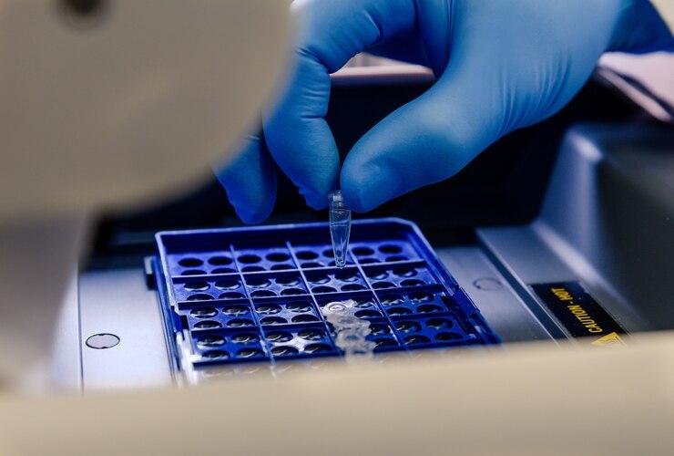 Magnetic Beads Protein A