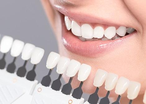 Teeth Whitening in Canberra
