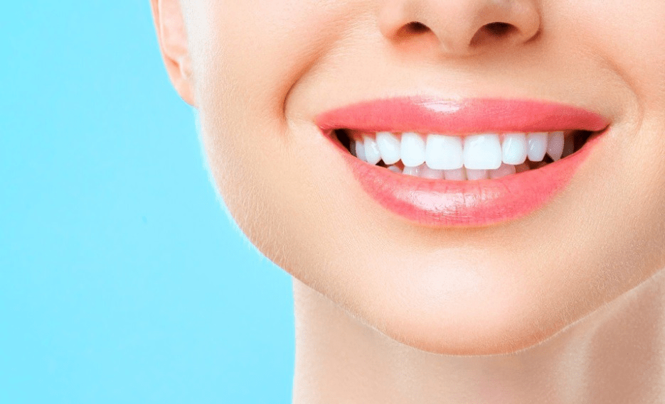Teeth Whitening in Canberra