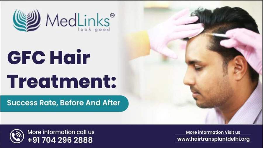 Understanding GFC Hair Treatment: Benefits, Process, and Results