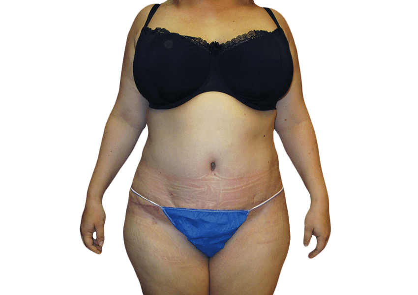 cosmetic body procedures houston