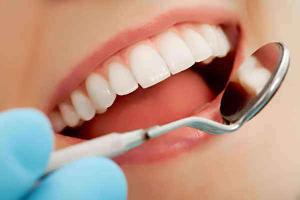 cosmetic dental bonding Houston